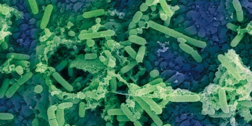 FermentationAsMetaphor_BlueStuff-Max-Quality Miso under Electron Microscope