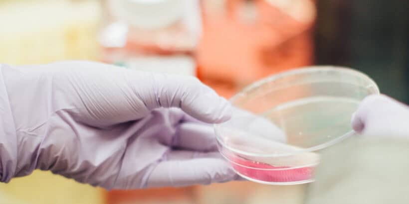 Bannersnack_Bacteria_TheArtofFermentation A hand wearing a rubber medical glove holding a tray with pink bacteria inside